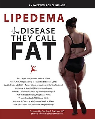 Read Online Lipedema - The Disease They Call FAT: An Overview for Clinicians - Erez Dayan | PDF
